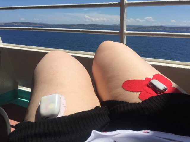 8 DÍAS SIN MI SISTEMA DIY DE PÁNCREAS ARTIFICIAL #OPENAPS