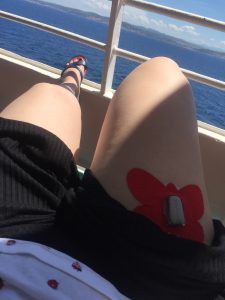 pierna con dexcom al sol