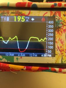 gráfica sensor glucemia dexcom g4 gráfica dexcom 24h